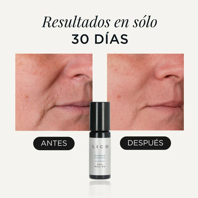 Roll-on Lico Fill